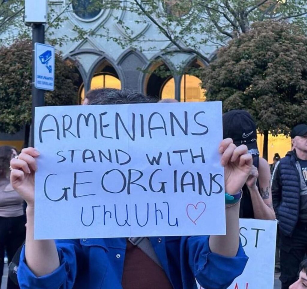 In this case, I REALLY STAND BY YOU, and as I noticed majority of Armenians do!