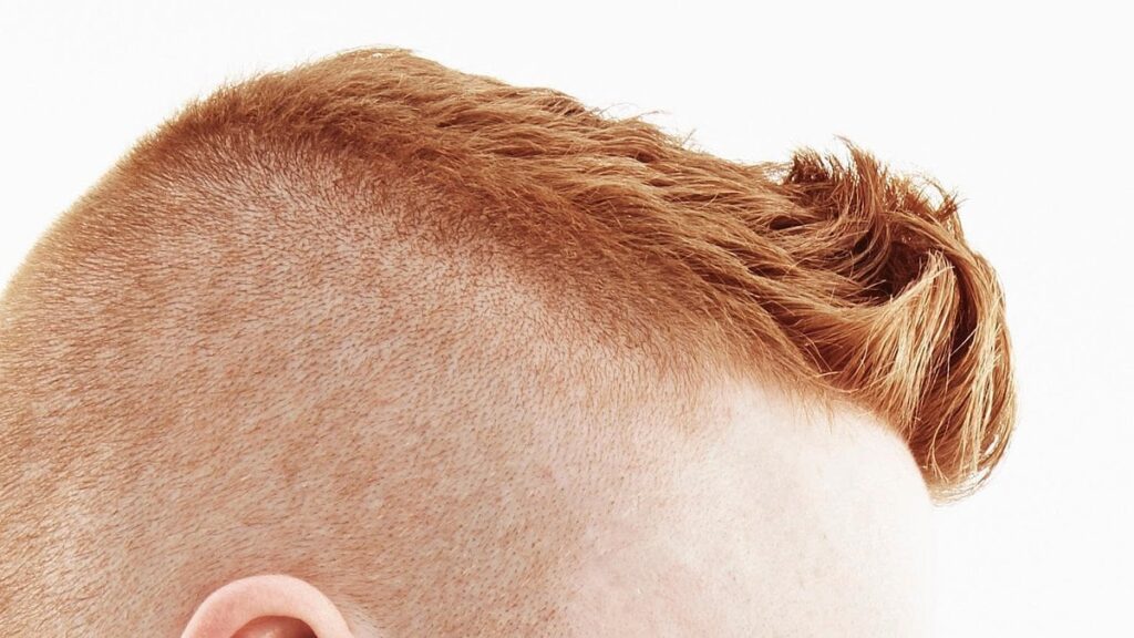 Ginger job centre boss who compared bullying over his hair colour to the prejudice faced by black people was not being racist, tribunal rules Ginger job centre boss who compared bullying over his hair colour to the prejudice faced by black people was not being racist, tribunal rules