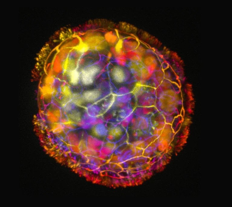 Tufts University scientists create tiny biological robots from human stem cells that can heal neuron tissue.