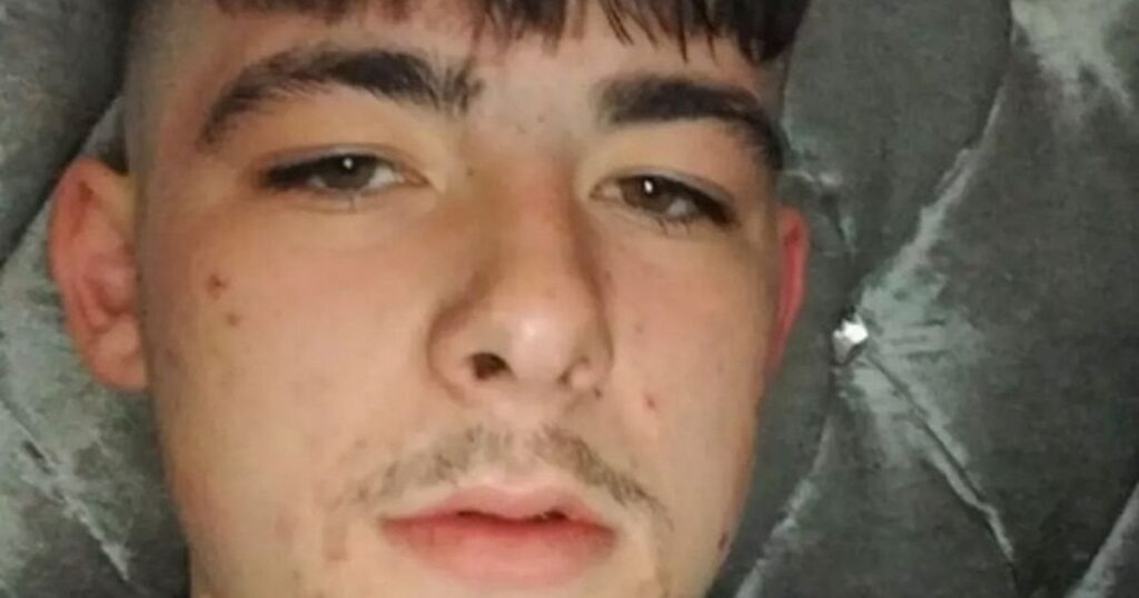 Teen's head split open in attack by yobs who chased him 'like pack of gorillas'