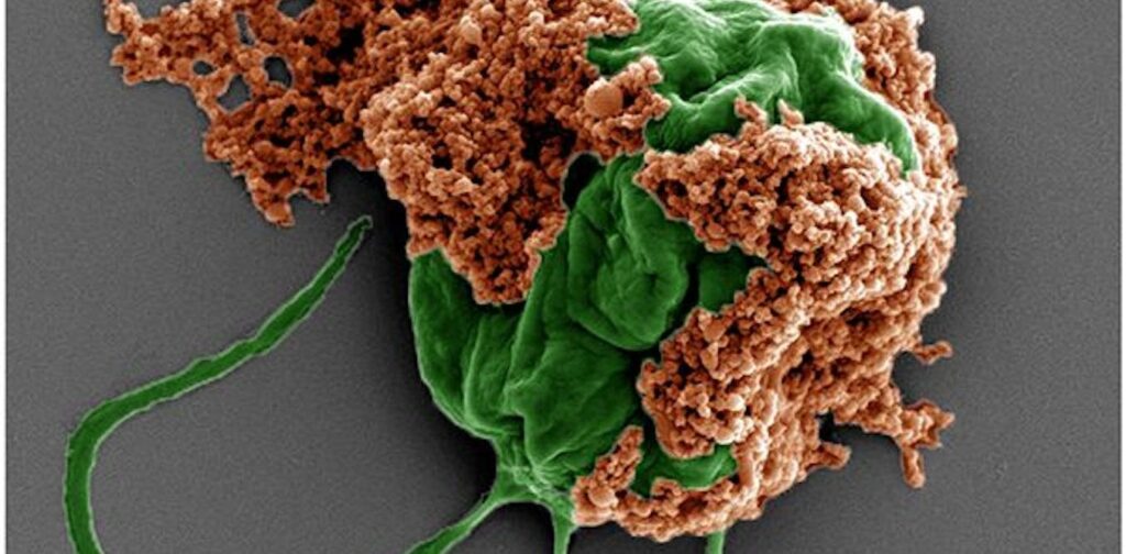 Biohybrid microrobots made from green algae carrying nanoparticles coated with red blood cell membranes and with and chemotherapy drugs inside can deliver the drugs directly to tumors Biohybrid microrobots made from green algae carrying nanoparticles coated with red blood cell membranes and with and chemotherapy drugs inside can deliver the drugs directly to tumors