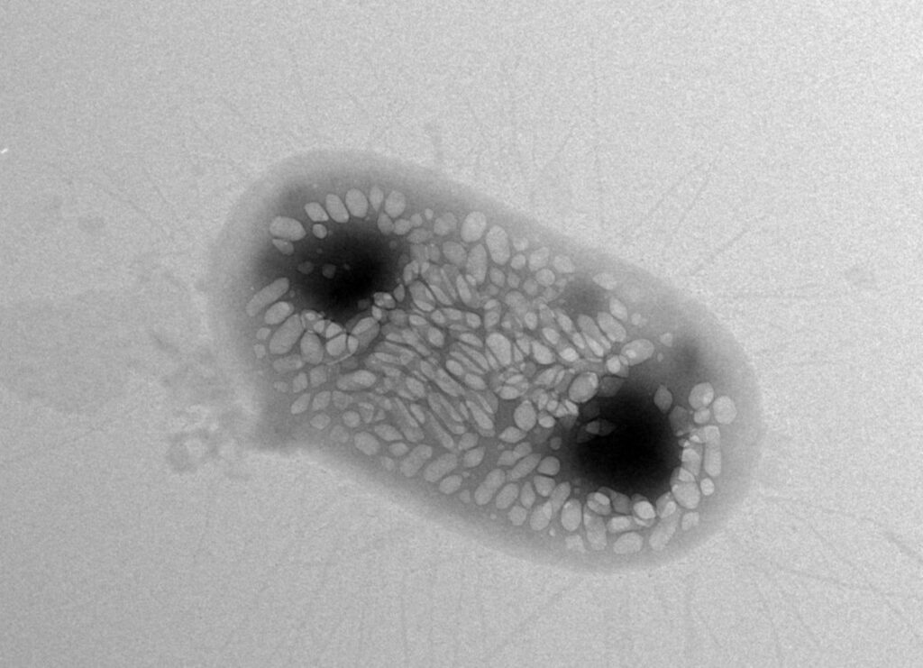Ultrasound can now be used to image single cells inside the body