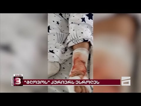 The legs of the courier of Glovos were shot because of one beer, and for the second day no one was arrested - no doubt they are the children of the owner, that's why the police are not doing anything.