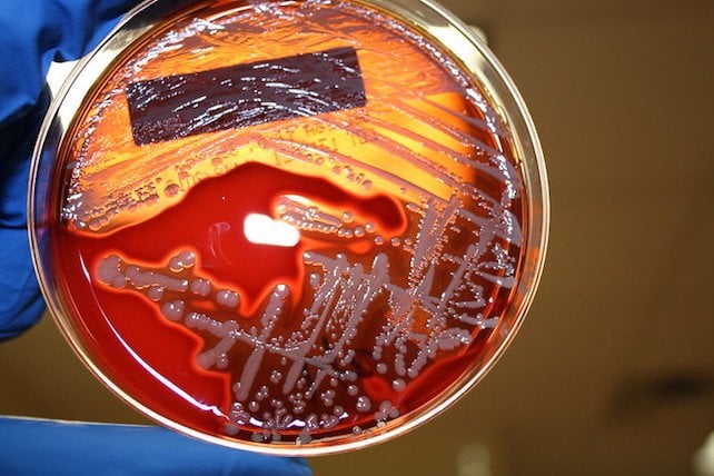 New Dual-Target Drug Could Make Antibiotic Resistance 100 Million Times Harder