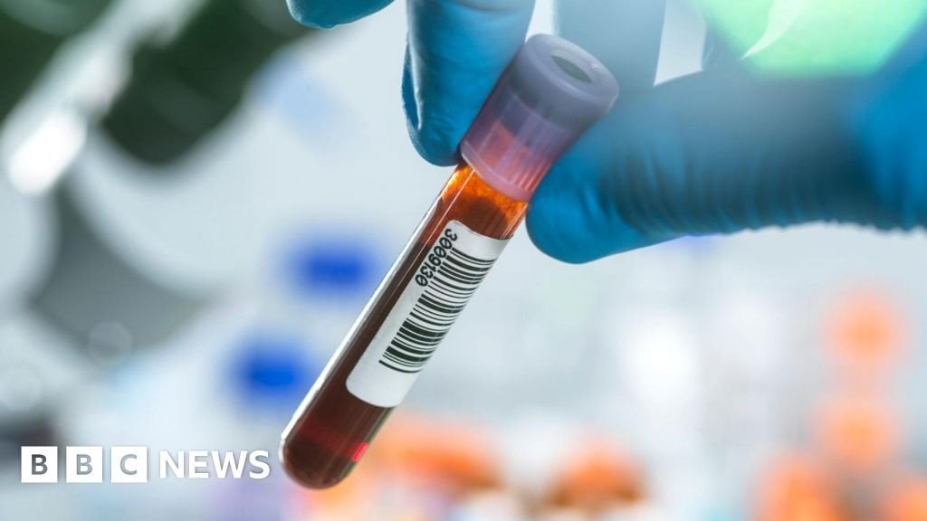 Woman needed HIV test after old genital swab used