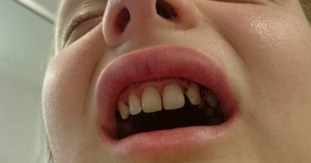 Girl who had wrong tooth extracted after admin blunder awarded huge payout