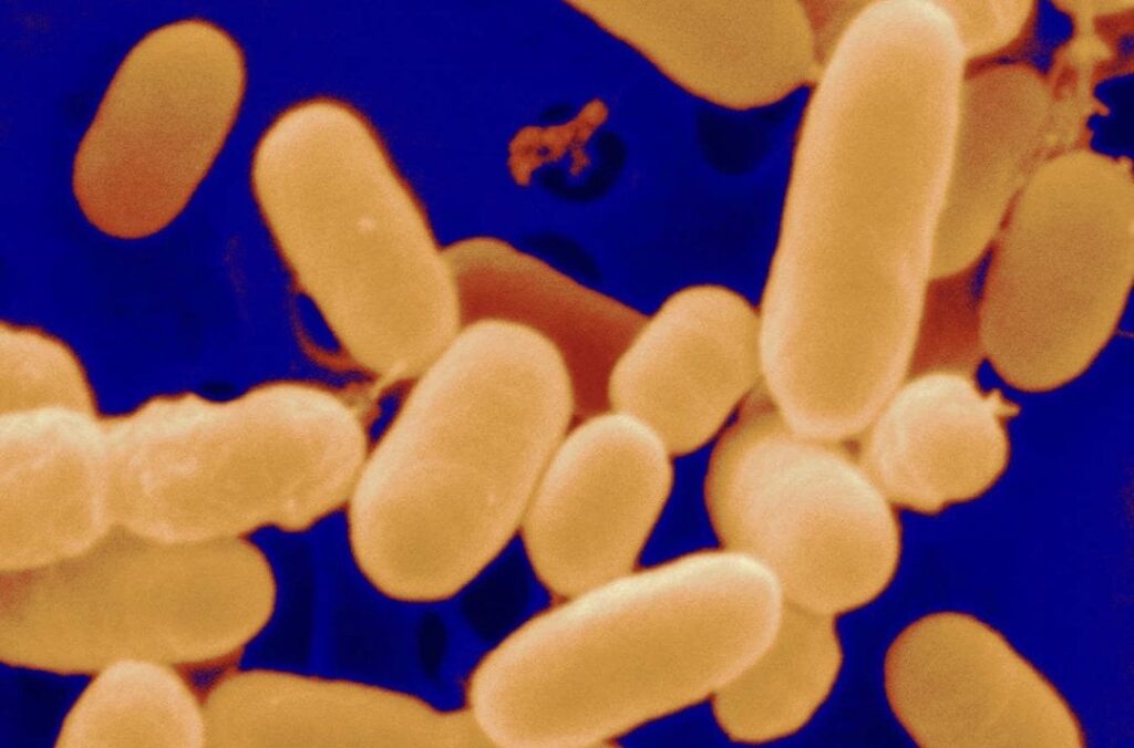 Miracle Bacteria from Feces: A New Solution for Chronic Wound Healing