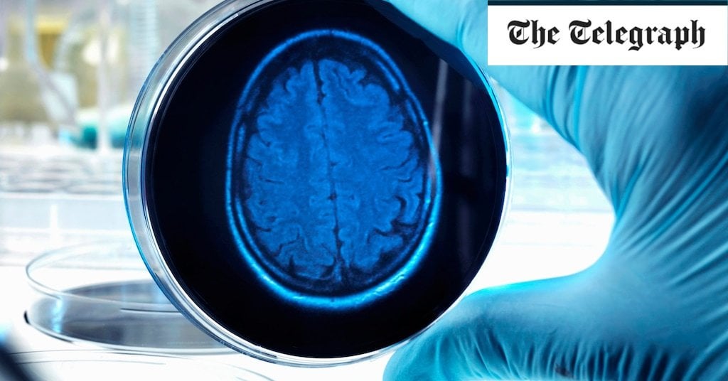 Alzheimer’s wonder drug gets the green light
