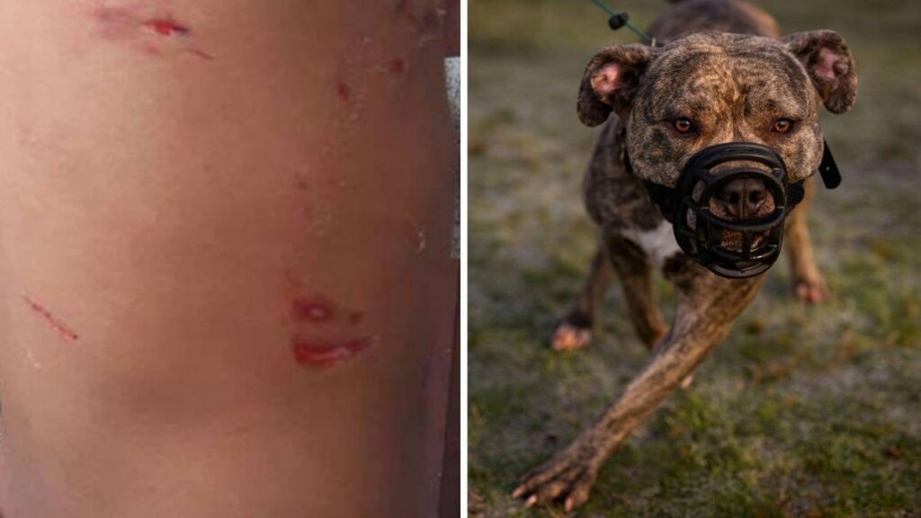Girl, 4, rushed to hospital after being mauled by two 'XL Bullies' while playing in park with mum