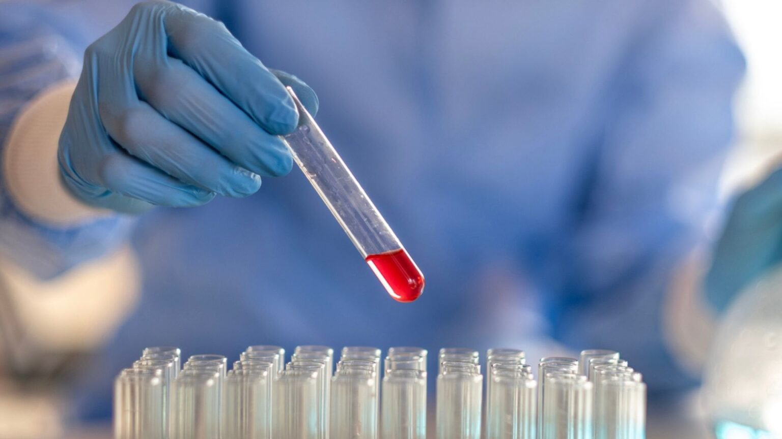 Red to rescue: Scientists turn CO2 into a powerful cancer-fighting compound | A new bacteria-based technology could help combat climate change while producing a valuable antioxidant.