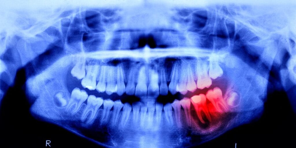 Human trials for teeth regeneration begin this month. What do you think is next?