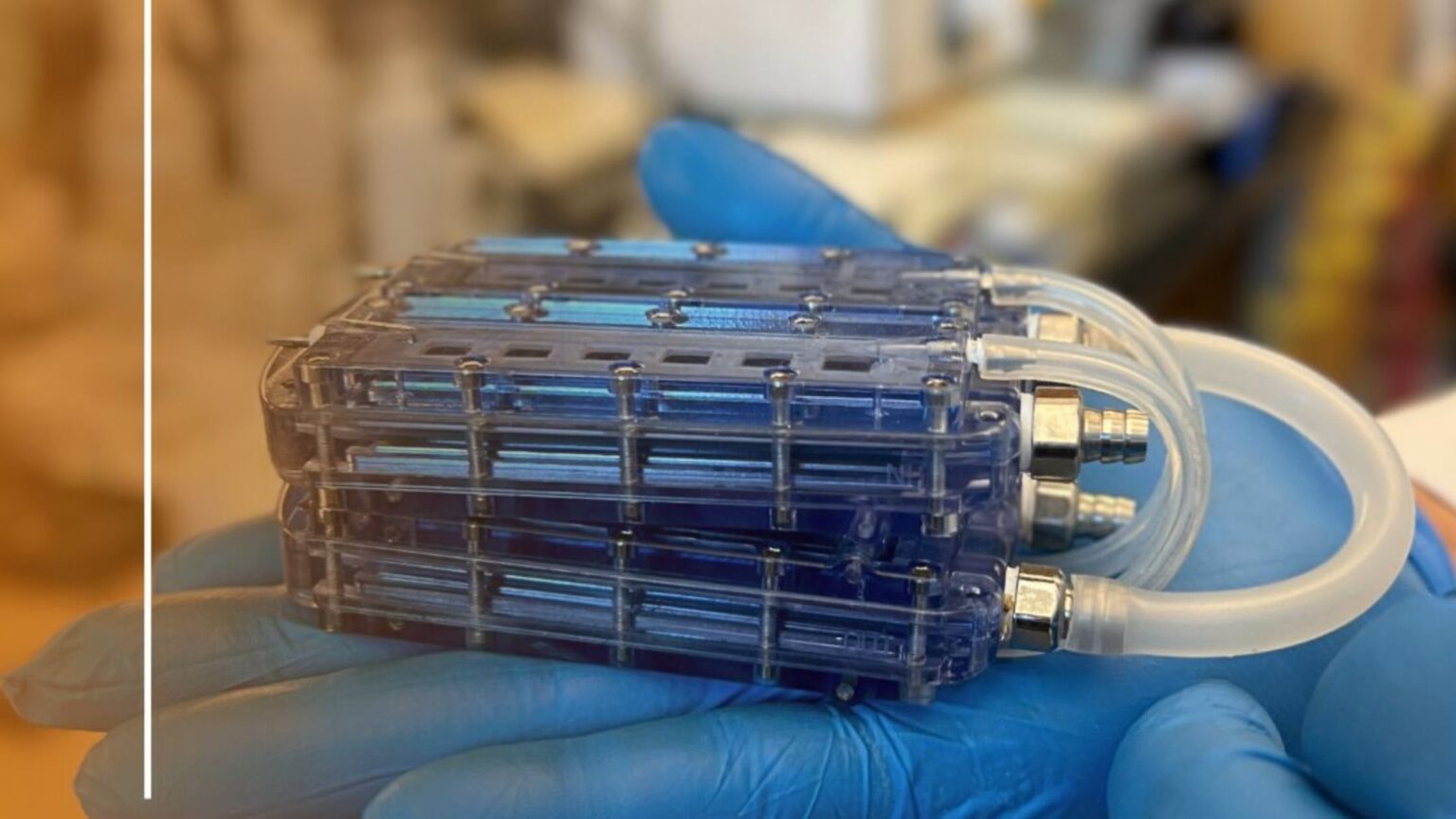 Bioartificial Kidney: A Breakthrough in Kidney Failure Treatment - TekGossip