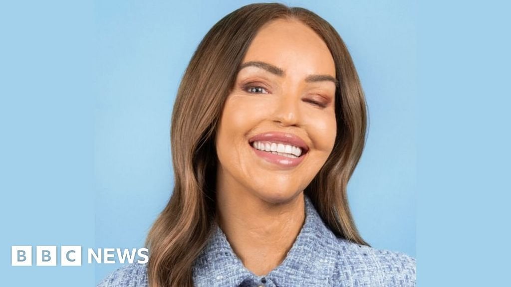 Katie Piper hikes mountain with burns survivors