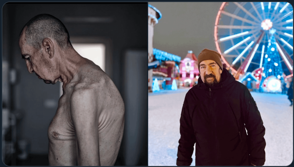 I was mentally ready, but when I saw my dad, it took 20 minutes for my eyes to get used to it. this is what he looks like now. was in captivity for 2 years and 4 months. the second photo is from January 2022, which I took before he left for Mariupol - Alina