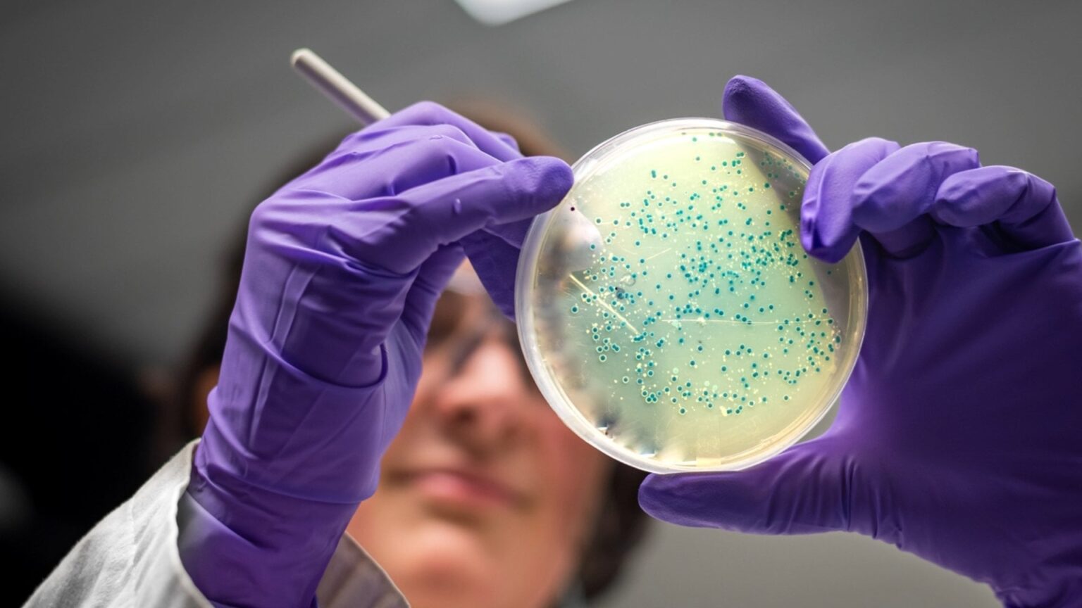 Mussel-inspired sticky bacteria breaks down tough plastic waste faster | Researchers developed adhesive bacteria and proteins that can help break down PET more efficiently, this could be a valuable tool in reducing plastic pollution worldwide.