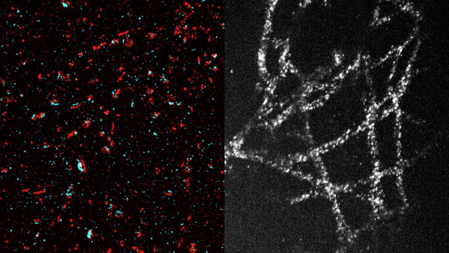 Forget super microscopes, MIT’s tissue expansion makes nanoscale imaging affordable