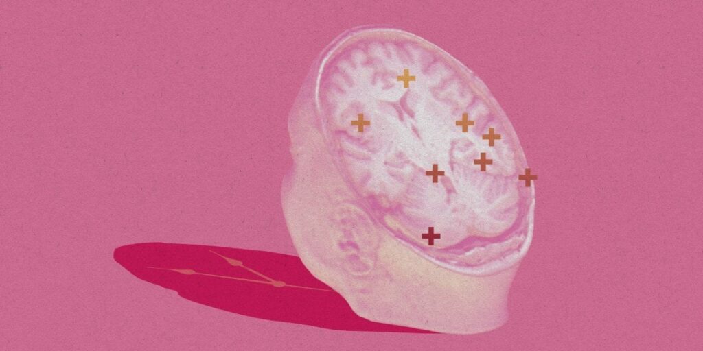 This researcher wants to replace your brain, little by little. The US government just hired a researcher who thinks we can beat aging with fresh cloned bodies and brain updates.