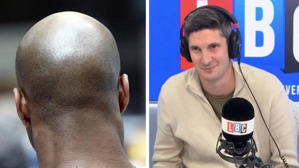 Calling a man 'bald' is sexual harassment, High Court rules