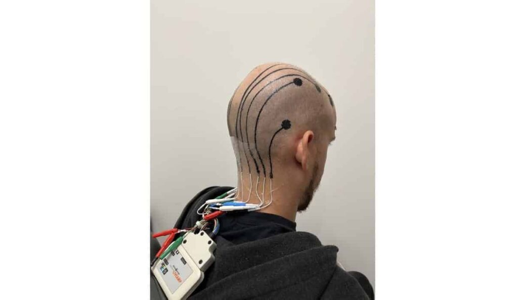 Temporary scalp e-tattoos that scan brain could replace traditional EEGs forever | Scientists have developed spray-on electronic tattoos that could be a game-changer in brain monitoring.