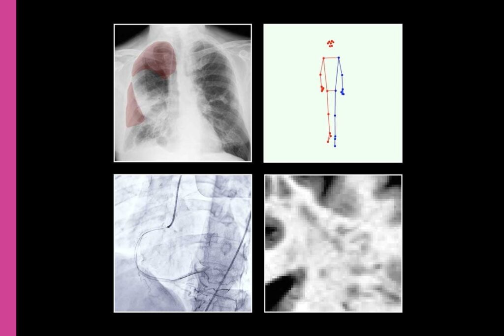 4 Ways Artificial Intelligence is Poised to Transform Medicine - AI can compare thousands of images to uncover dangerous patterns, create ultra-high resolution scans from low-res images and see what the human eye misses.