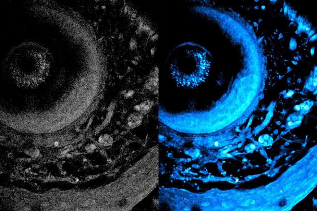 MIT: Non-invasive imaging method can penetrate deeper into living tissue