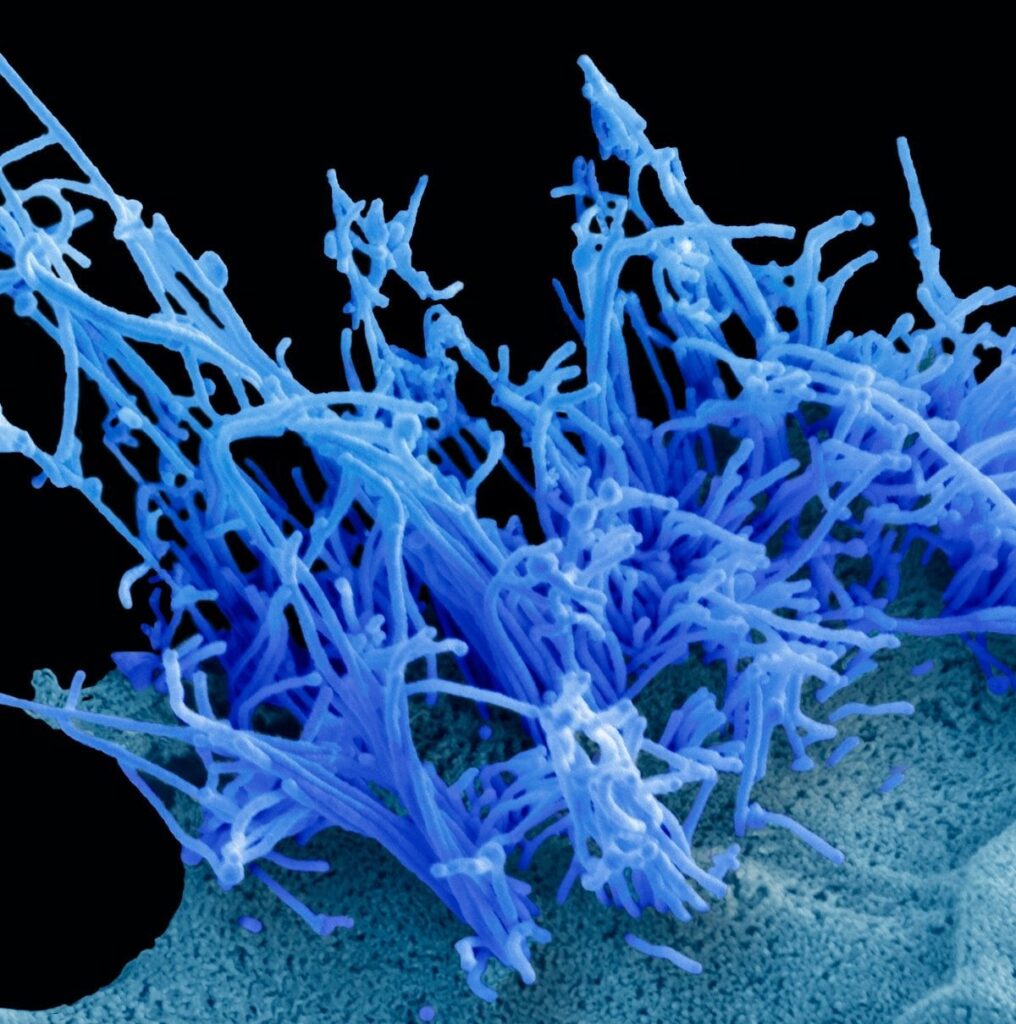 The chances of a second global pandemic on the scale of Covid keep increasing. The H5N1 Bird Flu virus, widespread on US farms, is now just one genetic mutation away from adapting to humans.