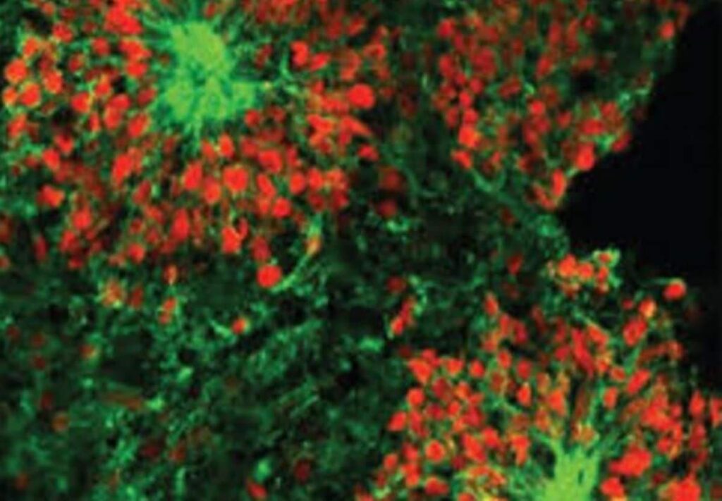 Space Study Reveals Accelerated Growth of Human Brain Cells