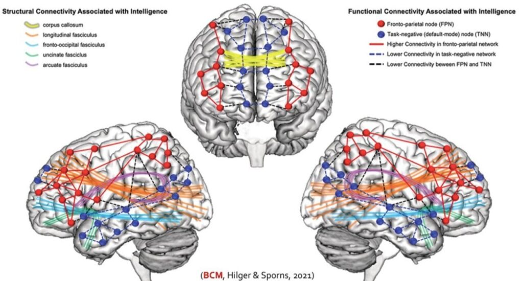 Neuroscientists develop machine learning models to predict human intelligence