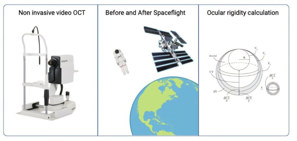 Astronauts' eyes weaken during long space missions, raising concerns for Mars travel
