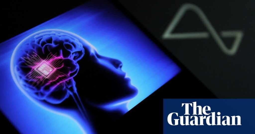 Brain implant that could boost mood by using ultrasound to go under NHS trial | Devices may have potential to help patients with conditions such as depression, addiction, OCD and epilepsy