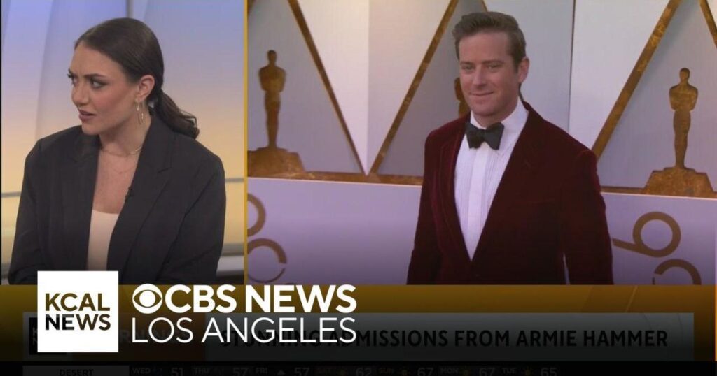 Armie Hammer's stunning admission and other entertainment news