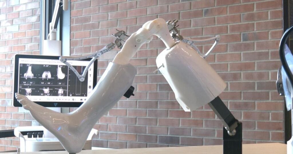 Robotic surgery technology arrives at Missoula Bone & Joint | Missoula News