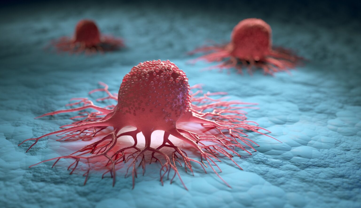 Scientists discover a molecular switch that can reverse cancer—turning colon cancer cells back into their healthy counterparts | The researchers anticipate that the technology will be applied to create treatments to reverse other forms of cancer in the future.
