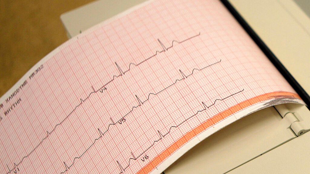 Heart monitor