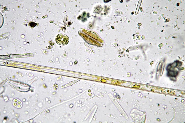 very small cellular organisms in light green and black against a white background.