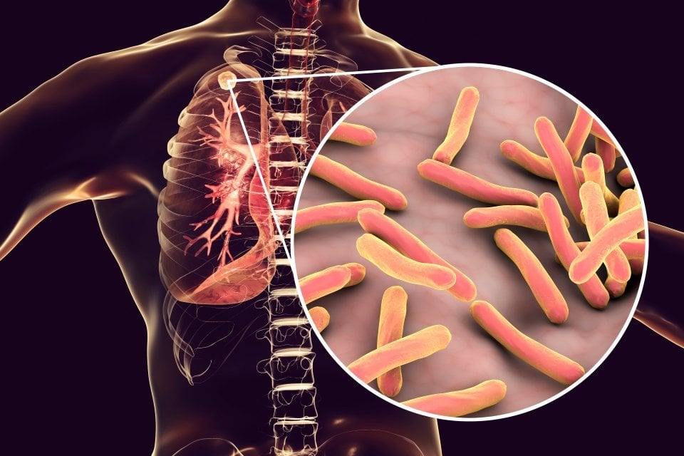 Designing Self-Destructing Bacteria to Make Effective Tuberculosis Vaccines