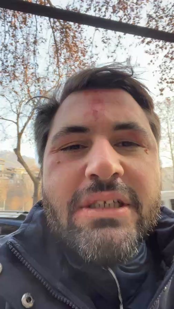 “Abu Dhabi” guy was attacked