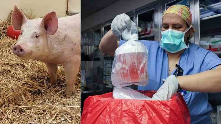 Doctors Successfully Transplant Gene-edited Pig Liver Into Human
