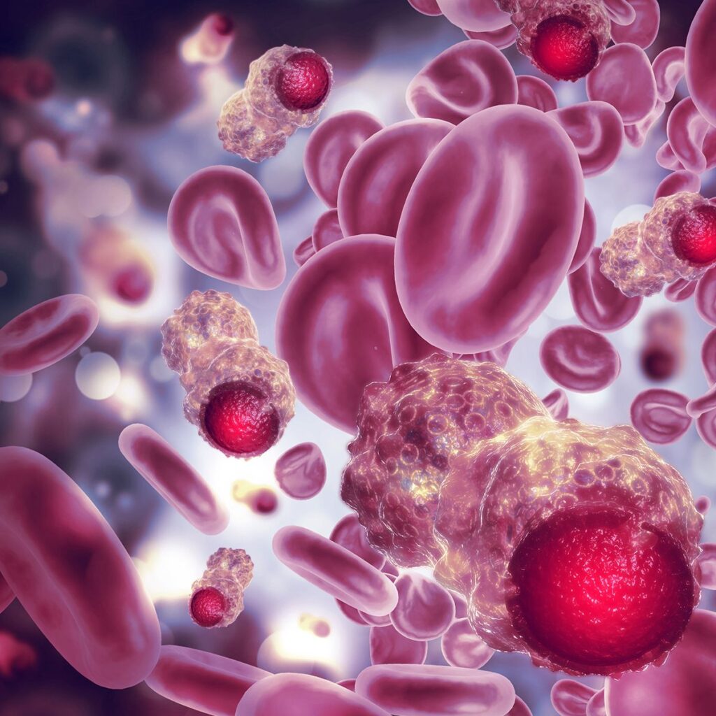 EU Approves Rytelo for Transfusion-Dependent Anemia in Low-Risk MDS