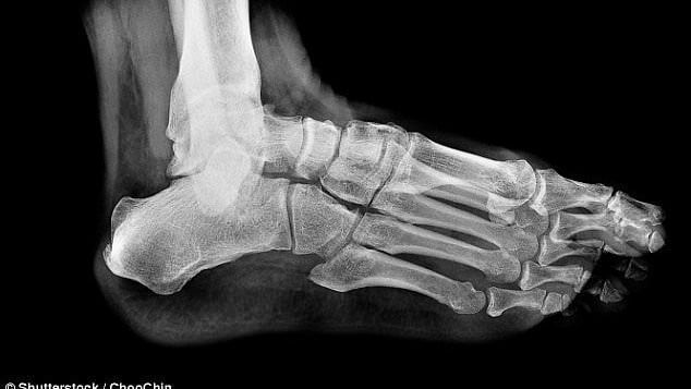 Female Indian radiographer at British hospital couldn't X-ray a foot - she'd claimed 23 years' experience on her CV but in fact was a receptionist