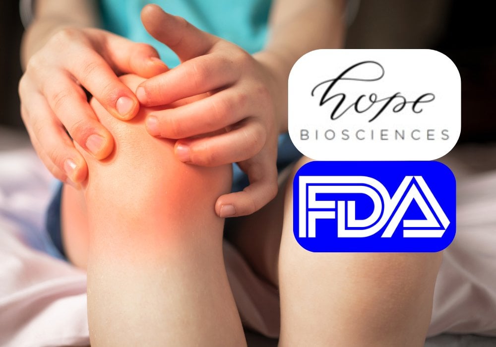 Hope Biosciences launches stem cell trial for children with arthritis (Juvenile Rheumatoid/Idiopathic Arthritis)