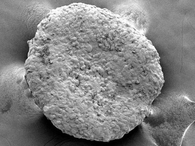 Experimental Treatment Uses Engineered Fat Cells to “Starve” Tumors: Researchers genetically engineered fat cells to aggressively consume nutrients. When implanted near tumors in mice, the tumors grew more slowly, and worked even when the engineered fat cells were implanted far from a tumor.