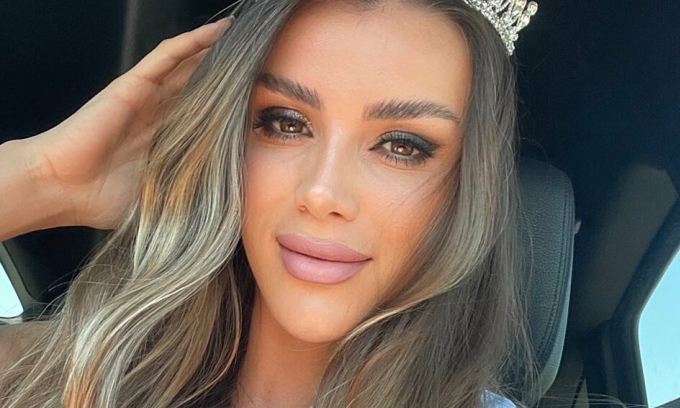 Kosovo beauty queen Güler Erdoğan dies at 27 after fall from bridge during alleged police chase