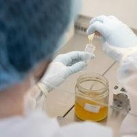 Austria trials DNA testing to uncover honey fraud | National
