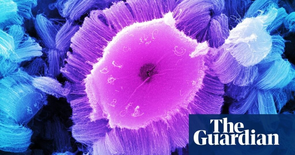 Top cancer experts ‘being put off UK by politicians’ messaging on immigration’