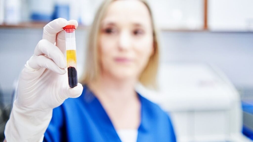 'Fingerprints of cancer' found after scientists flash infrared light pulses at blood samples