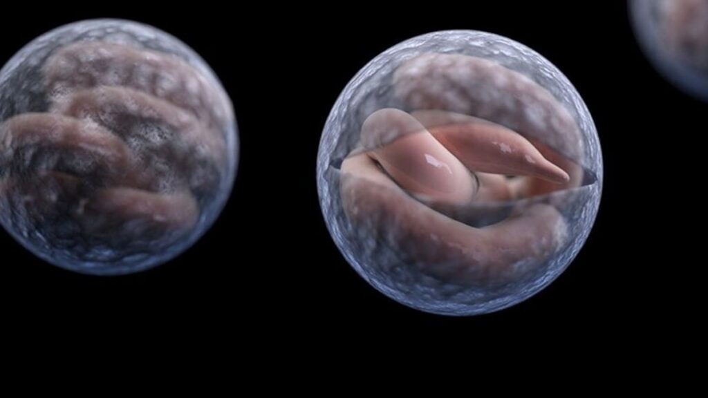 Wellington cryptosporidiosis outbreak: Kiwis warn of ‘brutal’ symptoms spreading through region