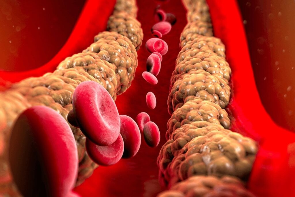 ‘This is revolutionary!’: Breakthrough cholesterol treatment can cut levels by 69% after one dose