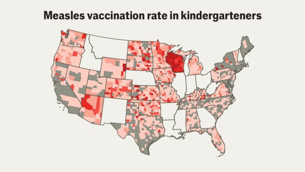 How much worse could America’s measles outbreak get? - The Economist