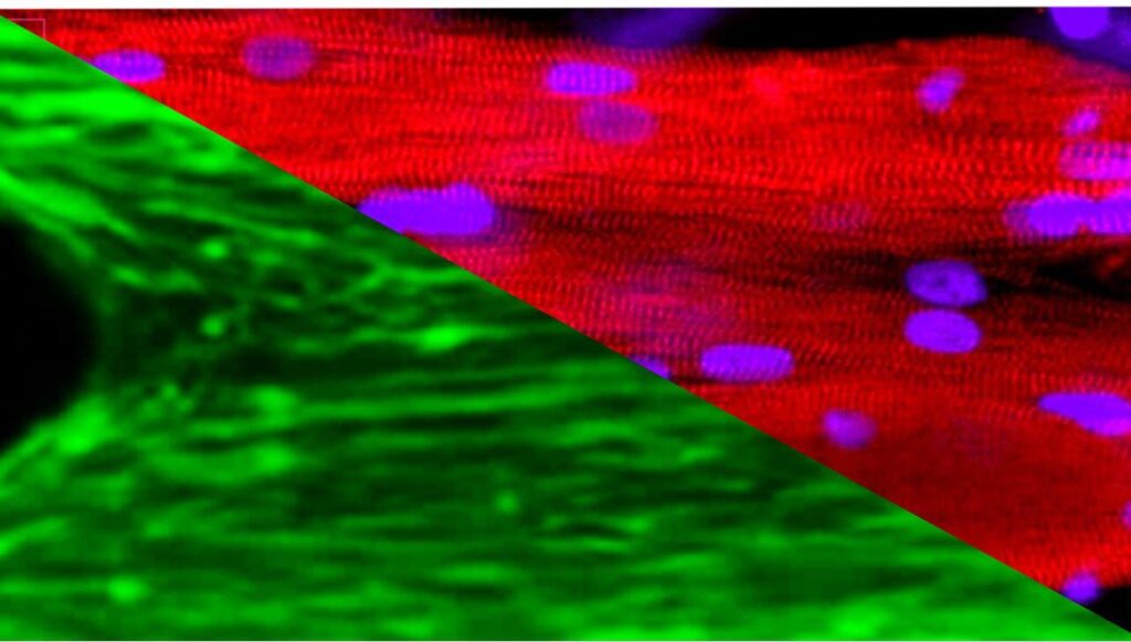 Space-grown muscle tissues reveal rapid aging-like decline in microgravity